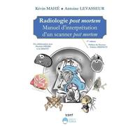 Radiologie post mortem Manuel d'interprétation d'un scanner post mortem - Kevin Mahé - Eska - broché - Scolaire / Universitaire