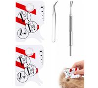 RAVNIX Ensemble Tire-Tiques 4 Pièces (2 Cartes + 2 Pinces) Avec Loupe - Retrait Précis & Sans Douleur pour Chiens, Chats & Enfants · Portable & Anti-infection