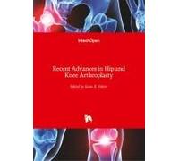 Recent Advances In Hip And Knee Arthroplasty