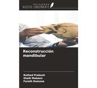 Reconstrucción mandibular
