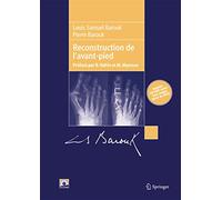 Reconstruction de l'avant-pied