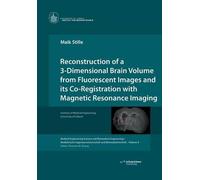 Reconstruction Of A 3-Dimensional Brain Volume From Fluorescent Images And Its Co-Registration With Magnetic Resonance Imaging