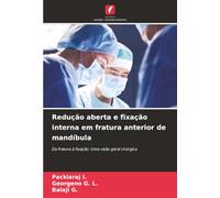 Redução aberta e fixação interna em fratura anterior de mandíbula: Da fratura à fixação: Uma visão geral cirúrgica