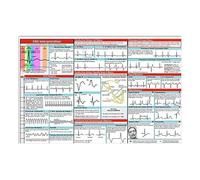 Règle ECG | Guide de connaissances d'interprétation ECG | Carte de poche ECG UK pour interprétation ECG/ECG, idéale pour les étudiants, les ambulanciers, les infirmières et les médecins