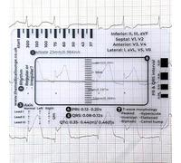 Règle ECG médicale, outil de mesure professionnel de la santé, guide d'analyse de la fréquence cardiaque et QRS
