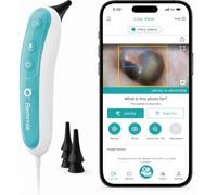 Remmie 4 otoscopes intelligents alimentés par l'IA