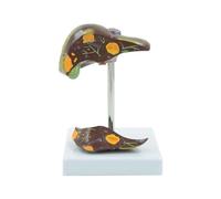 Removable Liver Anatomy Model Simulated Pathological Organ with Detachable Sections for Medical Education