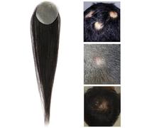 Remplacement De Cheveux Humains Naturels Pour La Zone Locale,Patchs De Perruque Invisibles Pour Le Front Favoris Franges SystèMes D'Extension De Cheveux(Circular,2.5x2.5cm)