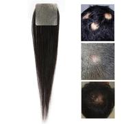 Remplacement De Cheveux Humains Naturels Pour La Zone Locale,Patchs De Perruque Invisibles Pour Le Front Favoris Franges SystèMes D'Extension De Cheveux(Square,3x3cm)