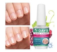 Renforceurs d'Ongles,Agent Protecteur Doux - Liquide de Réparation pour Ongles,pour les Doigts et les Orteils, Amis, Collègues, Enthousiastes, Maison, Salon