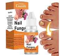 Réparation de lit d'ongles | Solution naturelle pour ongles d'orteils extra fort, solution de soin des ongles de 9,9 g pour réparer les ongles endommagés, liquide de restauration des ongles pour