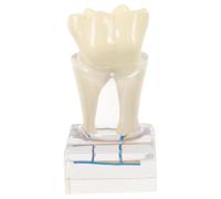 Résine Modèle de Dents D'enseignement à 6 Reprises | Démonstration et Pratique, Situation Buccale Simulée, Léger à Transporter, Destiné aux Étudiants et Patients