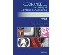 Imagerie Osseuse D'allure Tumorale - Cas Pratiques En Imagerie Musculosquelettique