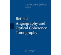 Retinal Angiography And Optical Coherence Tomography