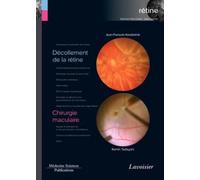 Décollement de la rétine / Chirurgie maculaire (volume 6 - coffret Rétine): (volume 6 - coffret Rétine)