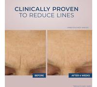 Retinol Creme Anti Ride 48g,Leichte Anti Aging Retinol,Creme Anti Rides Femme,Dratante Anti Rughe, Anti Rides Puissant Immediat,Mit Retinol,Hyaluronsäure, Soin Visage Hydratant, Repulpant Lissant Pou