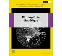 Rétinopathie diabétique