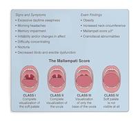 RNUMLIGH Education Poster Upper Airway Anatomy and Mallampati Score Reference Guide Wall-Art for Clinic Office or School Decor 8 X 12 in