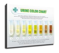 RNUMLIGH Gym Locker Room Poster Urine Color Chart Water Intake Guide for Bathroom Home Health Education(Unframed,16x24inch(40x60cm))