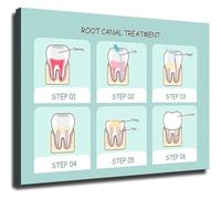 RNUMLIGH Oral Anatomy Chart Health Poster Canvas Wall-Art Tooth Diagram Educational Reference for Students Clinic Decor Home Office Library(Framed,08x12inch(20x30cm))