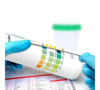 Roche Combur 3 Bandelettes Test Urine 50 Pièces Analogue