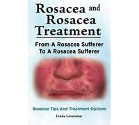 Rosacea And Rosacea Treatment. From A Rosacea Sufferer To A Rosacea Sufferer. Rosacea Tips And Treatment Options