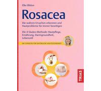 Rosacea: Die wahren Ursachen erkennen und Hautprobleme für immer beseitigen. Die 4-Säulen-Methode: Hautpflege, Ernährung, Darmgesundheit, Lebensstil