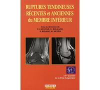 Ruptures tendineuses recentes et anciennes du membre superieur - Y CATTONE - Sauramps Medical - broché - Etude