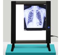 Rusopobe Instrument de visualisation de Film radiographique, équipement de Laboratoire de Film radiographique illuminateur Panneau Lumineux boîte de visualisation d'écran, sans Ombres