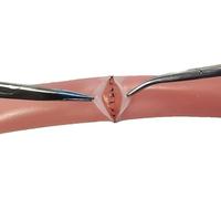 Ryanong Modèle de pratique de suture d'anastomose vasculaire chirurgicale, modèle d'outil d'entraînement de l'intestin simulé à double couche, modèle de suture muqueuse intestinale pour l'entraînement