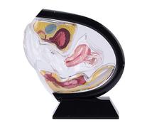 Ryanong Modèle utérin féminin transparent anatomie pelvienne cavité rectum enseignement médical éducatif noir