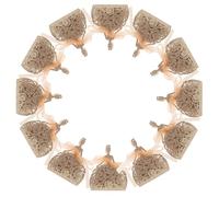 SAFIGLE Boîtes à Dragées pour Mariage 25 Pcs Pailletées Motif Ajouré Rose Doré avec Rubans, Coffrets Présents pour Invités, Emballage Friandises Portable Fêtes et Saint-valentin