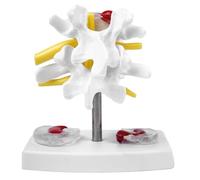 Sarini SariniDisque Lombaire Anatomique, modèle Scientifique de la Colonne vertébrale, Anatomie, hernie discale, modèle de démonstration, Colonne vertébrale Humaine, modèle de Disque