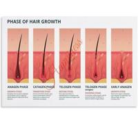 Scalp Hair Growth Phase Chart Canvas Wall Decor