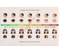 Scalp Health Chart Poster Canvas Painting Print