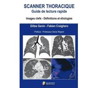SCANNER THORACIQUE. GUIDE DE LECTURE RAPIDE: IMAGE CELFS. DEFINITION ET ETIOLOGIES