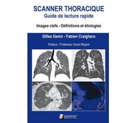Scanner thoracique. guide de lecture rapide Image celfs. definition et etiologies - CRAUIGHERO - Sauramps Medical - broché - Scolaire / Universitaire