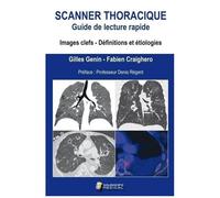 Scanner Thoracique : Guide De Lecture Rapide - Images Clefs, Définitions Et Étiologies