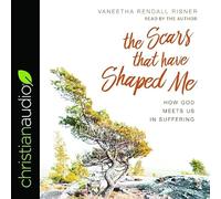 Scars That Have Shaped Me: How God Meets Us in Suffering