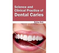 Science And Clinical Practice Of Dental Caries