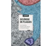 Sclérose en plaques