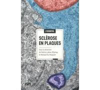 Sclérose en plaques