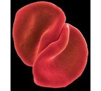 Scratch My Back [Import]