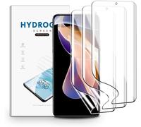 Screen Protector Films For Xiaomi Redmi Note 11 Pro+ 5g,3 Pieces Hydrogel Transparent Hd Soft Tpu Screen Protector Film Anti-Fingerprint