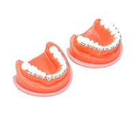 SdaryWare Modèle de dent de Typhon - Modèle éducatif, modèle de Dents orthodontiques - Modèle d'enseignement des Dents buccales simulées - pour l'enseignement des Sciences, la Recherche,A