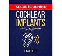 SECRETS BEHIND COCHLEAR IMPLANTS