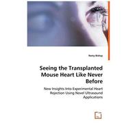 Seeing The Transplanted Mouse Heart Like Never Before