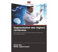 Segmentation des régions cérébrales: Des réseaux neuronaux convolutifs aux solutions de nouvelle génération
