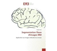 Segmentation floue d'images IRM Application aux images médicales du cerveau - Nadjib Nasri - Universitaires Europeennes - broché - Livre