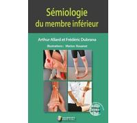 SEMIOLOGIE DU MEMBRE INFERIEUR